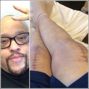 FRED HAMMOND UPDATE: Singer Continues to Learn How to Walk After Double Knee Replacement